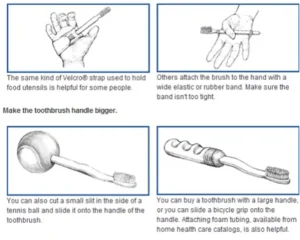 alzheimer's teeth brushing