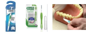 alzheimer's flossing